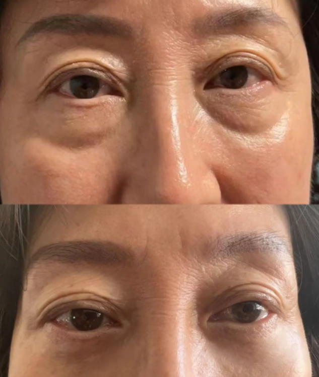 有美严选，您的美丽守护者