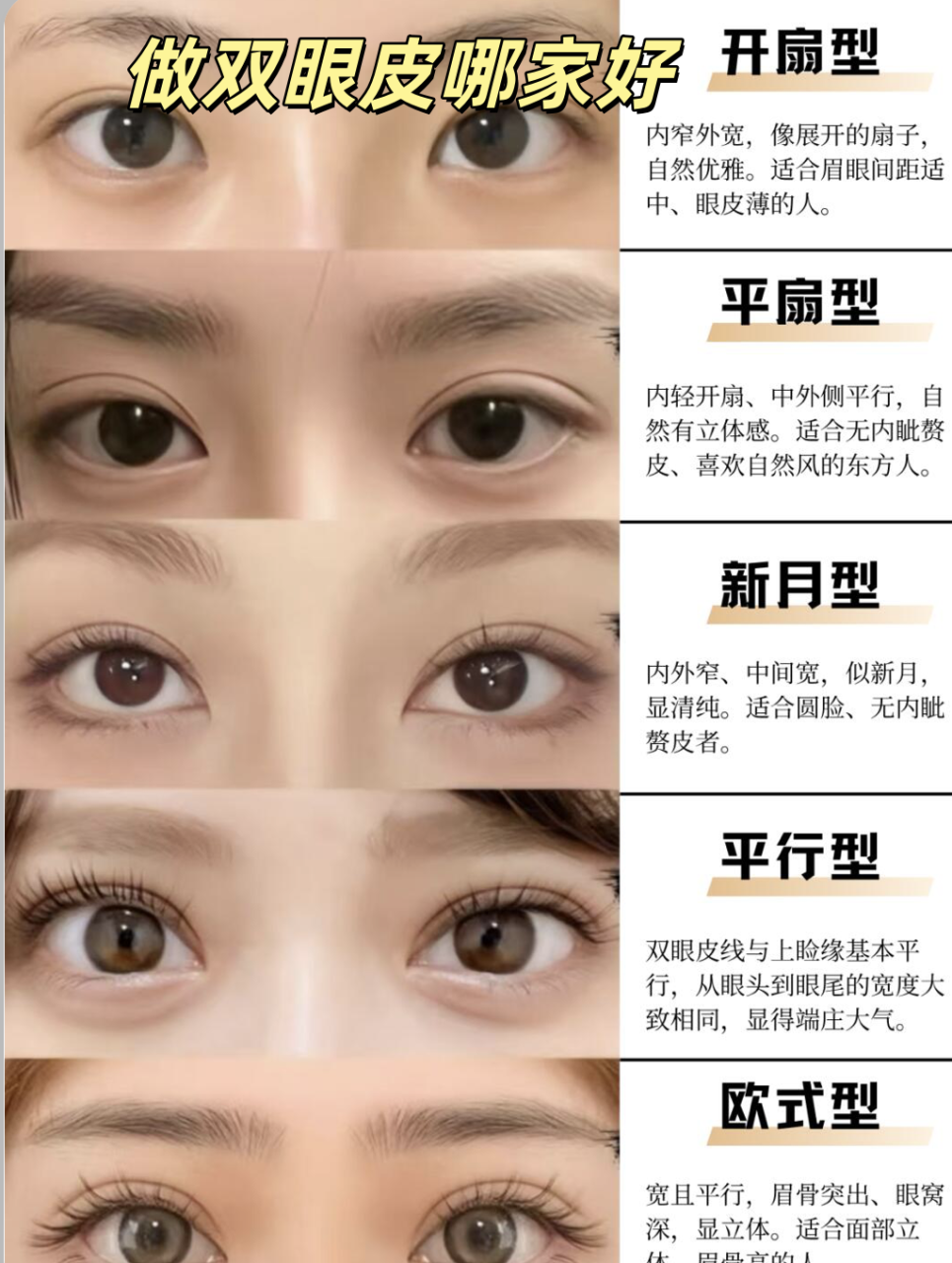 眼综合与单纯双眼皮的区别有哪些?眼综合手术与传统双眼皮手术之间的差异插图2 如何选择最适合自己的方式?