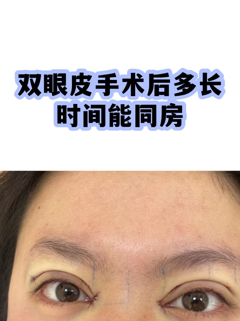 如何加速恢复？