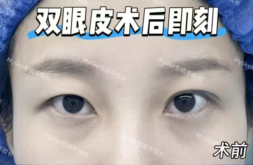术前