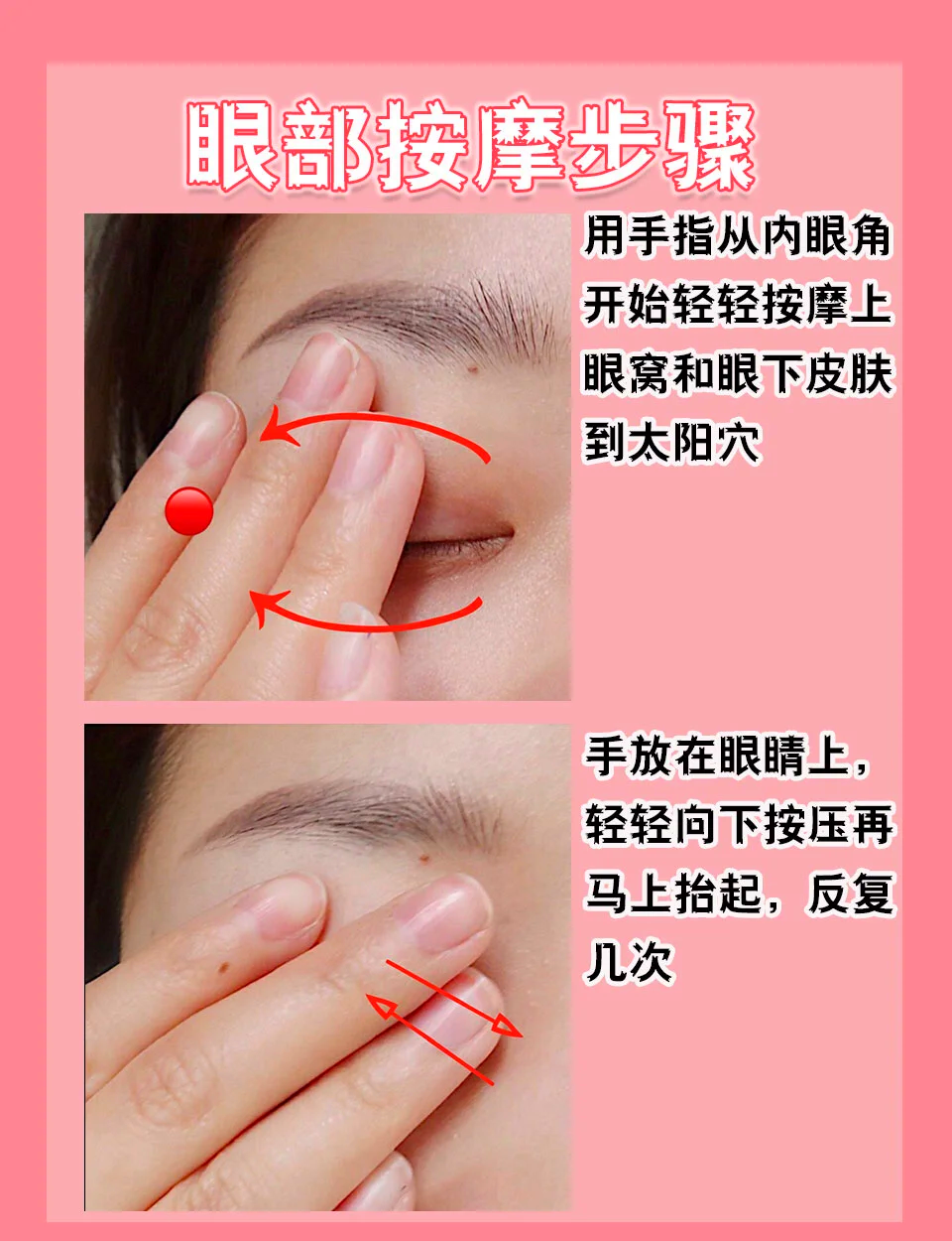 去眼袋真的会反弹吗？如何避免去眼袋后出现反弹现象