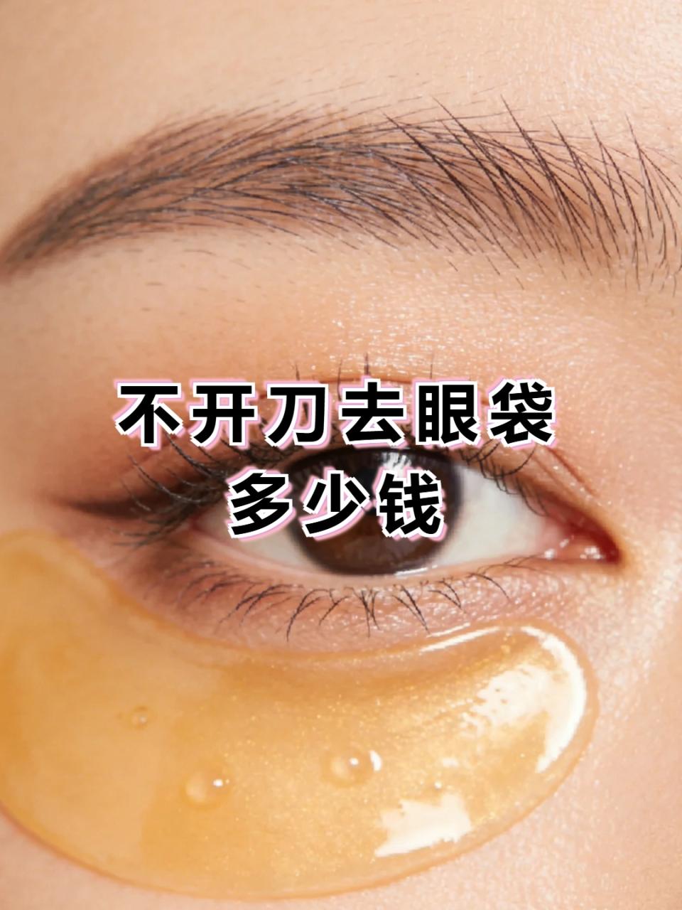 广州不开刀去眼袋价格多少钱？非手术去除眼袋费用及效果