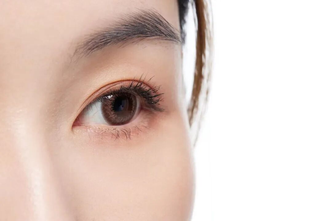 开内眼角与外眼角对比哪个更显眼大？恢复期又需多久？