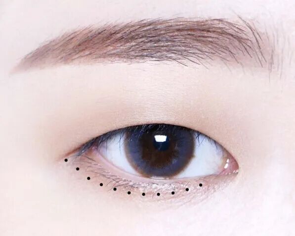 双眼皮术前必看！价格、眼型、优缺点，一次讲透！