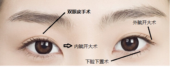 开外眼角疼吗？