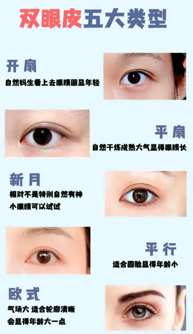 埋线和全切双眼皮哪个好？埋线与全切双眼皮手术效果对比