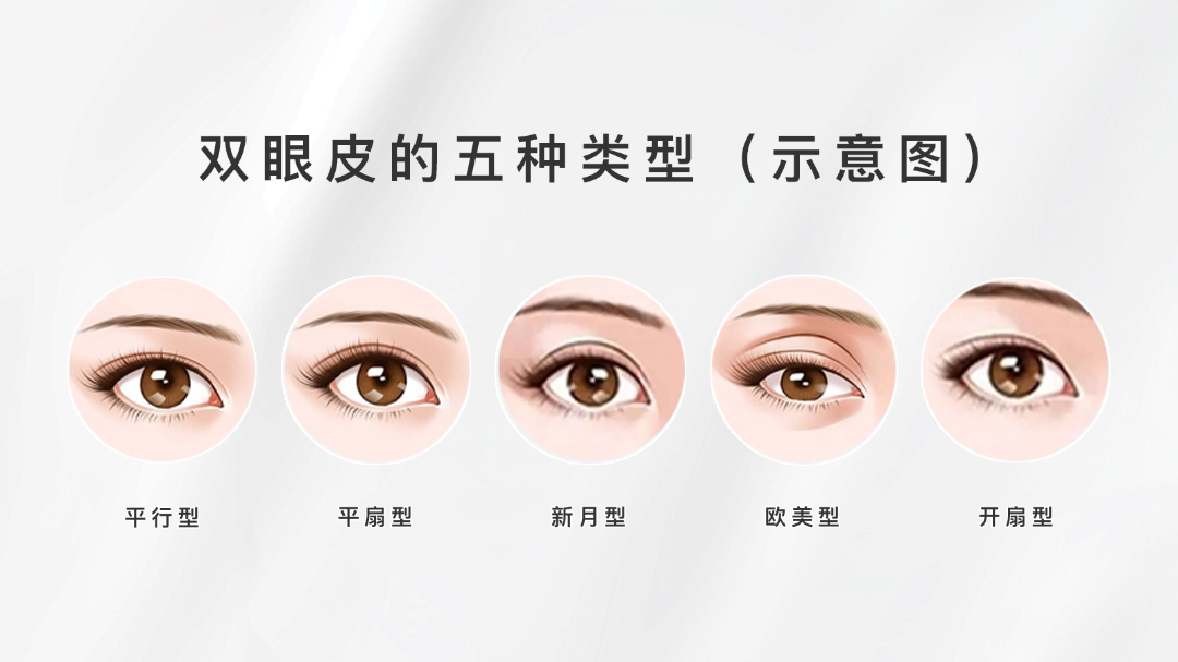 上海割双眼皮一般多少钱?影响双眼皮价格的因素有哪些?