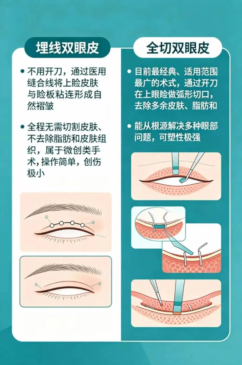 武汉割双眼皮与埋线的区别？武汉割双眼皮与埋线双眼皮哪个效果好？