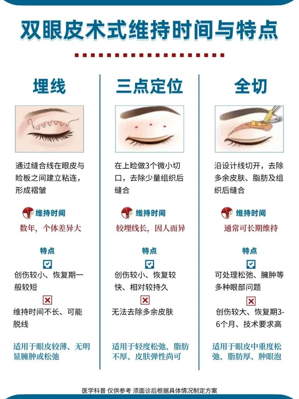 双眼皮手术多少钱一次？哪种双眼皮手术更好？
