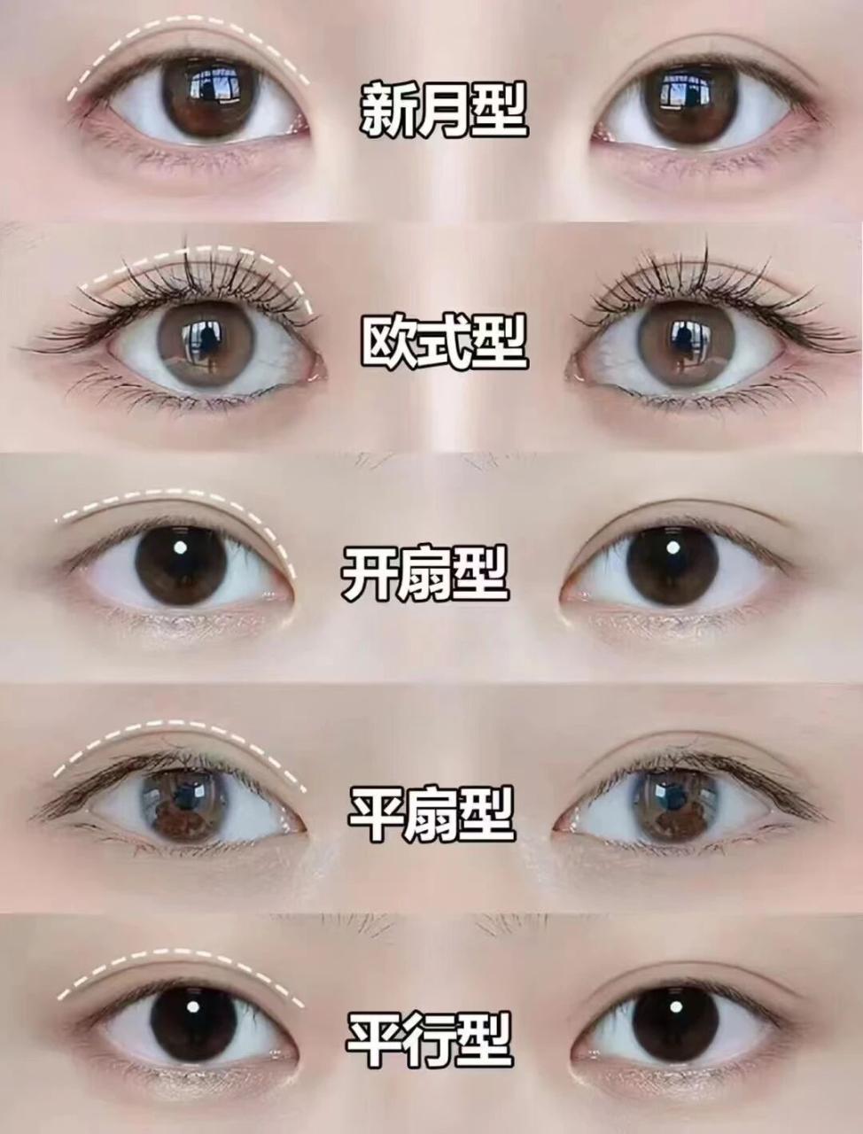 整双眼皮需要多少钱？整双眼皮需要知道哪些事？
